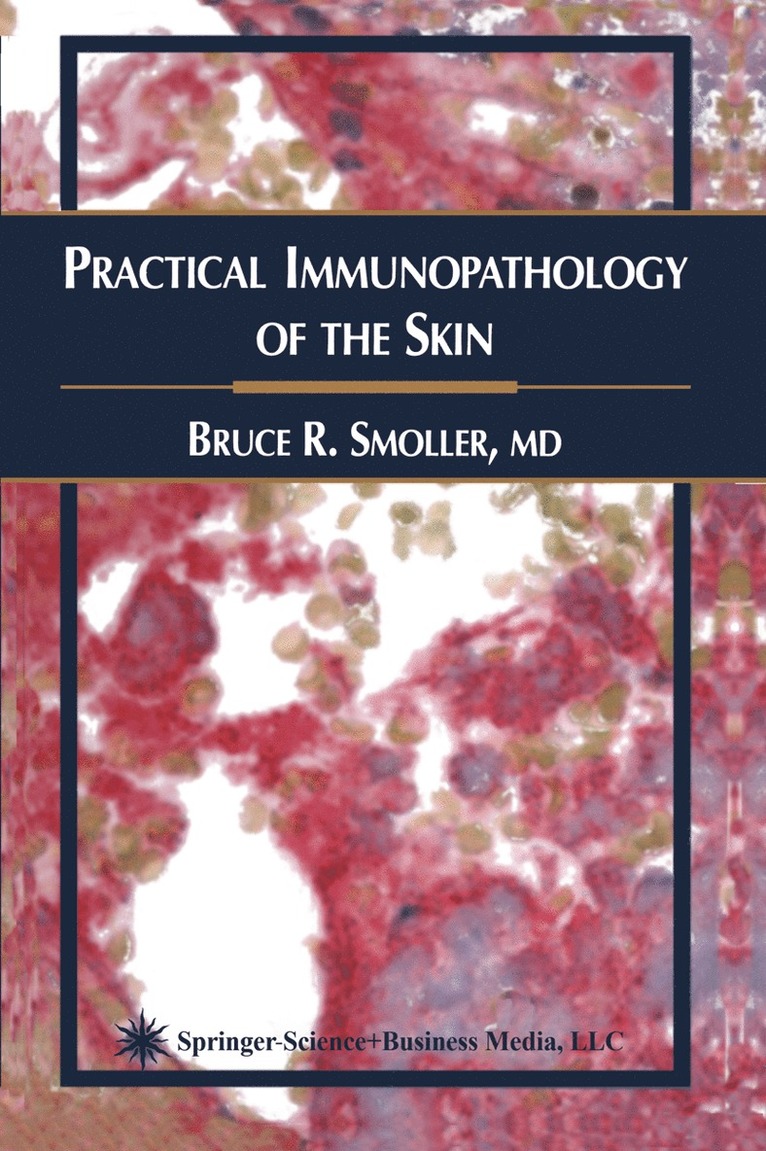 Practical Immunopathology of the Skin 1