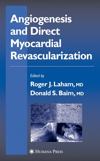 bokomslag Angiogenesis and Direct Myocardial Revascularization