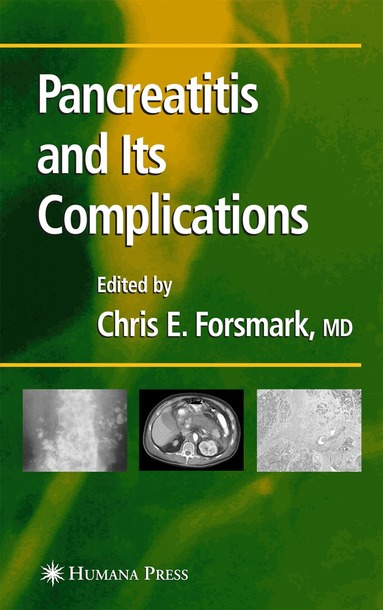 Chris E. Forsmark - Pancreatitis and Its Complications, Häftad