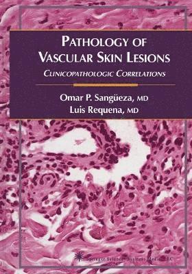 Pathology of Vascular Skin Lesions 1