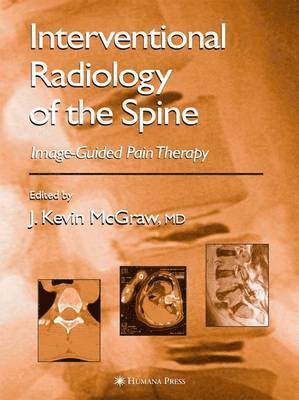 Interventional Radiology of the Spine 1