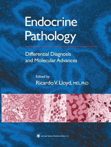 Ricardo V. Lloyd - Endocrine Pathology, Häftad