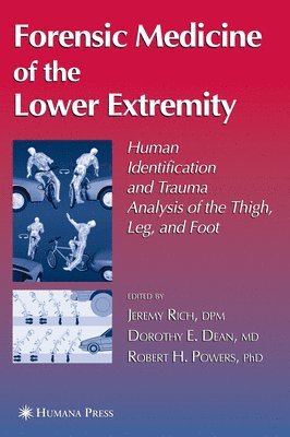 Forensic Medicine of the Lower Extremity 1