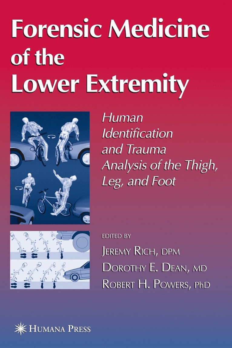 Forensic Medicine of the Lower Extremity 1