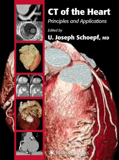 U. Joseph Schoepf - CT of the Heart, Häftad