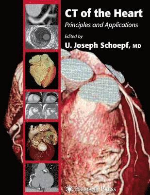 U. Joseph Schoepf - CT of the Heart, Häftad