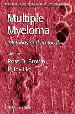 Multiple Myeloma 1