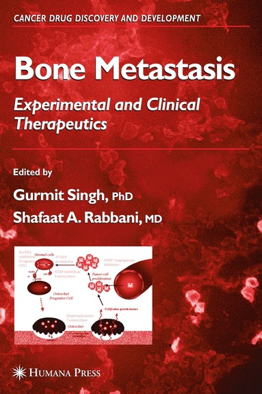 bokomslag Bone Metastasis