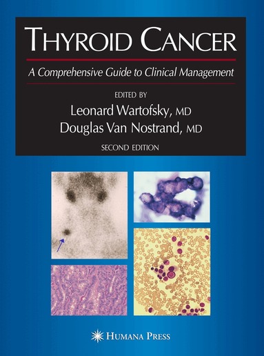Leonard Wartofsky, Douglas Van Nostrand - Thyroid Cancer, Häftad