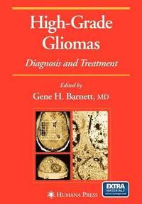 bokomslag High-Grade Gliomas