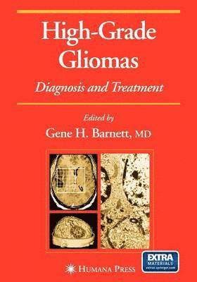 bokomslag High-Grade Gliomas