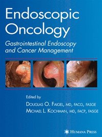bokomslag Endoscopic Oncology