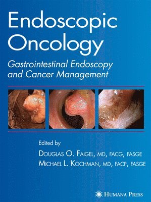 Endoscopic Oncology 1