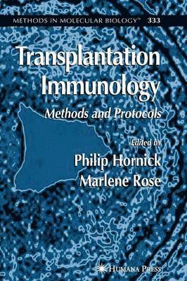 Transplantation Immunology 1