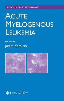 Acute Myelogenous Leukemia 1