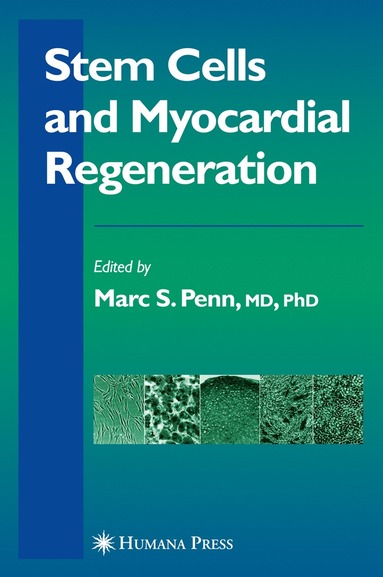 bokomslag Stem Cells and Myocardial Regeneration