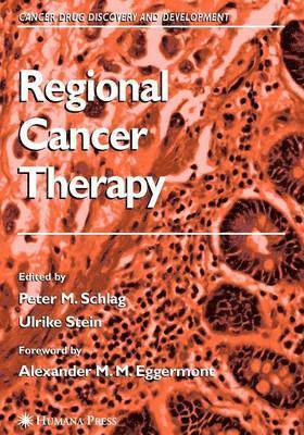 Regional Cancer Therapy 1