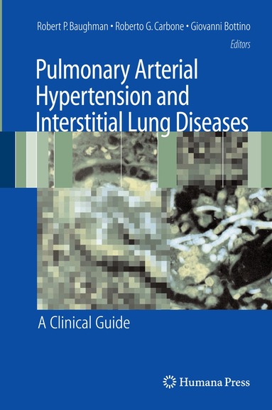 Robert P. Baughman, Roberto G. Carbone, Giovanni Bottino - Pulmonary Arterial Hypertension and Interstitial Lung Diseases, Häftad