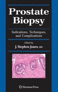 bokomslag Prostate Biopsy
