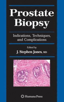 Prostate Biopsy 1