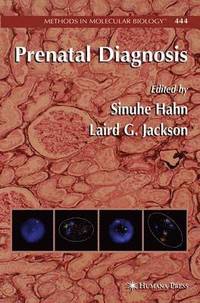 bokomslag Prenatal Diagnosis