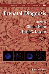 bokomslag Prenatal Diagnosis