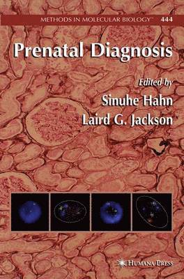 Prenatal Diagnosis 1