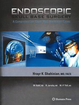 bokomslag Endoscopic Skull Base Surgery