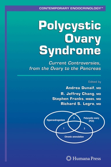 Andrea Dunaif, R. Jeffrey Chang, Stephen Franks, Richard S. Legro - Polycystic Ovary Syndrome, Häftad