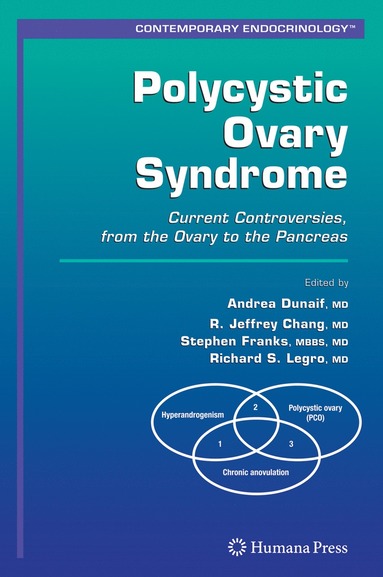 bokomslag Polycystic Ovary Syndrome