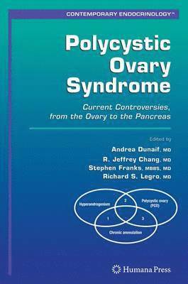 Polycystic Ovary Syndrome 1