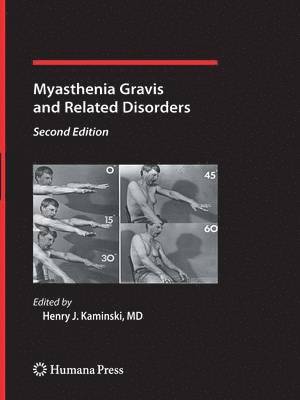 Myasthenia Gravis and Related Disorders