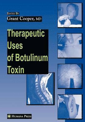 Therapeutic Uses of Botulinum Toxin 1
