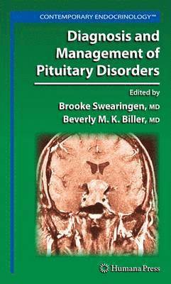 Brooke Swearingen, Beverly M. K. Biller, Beverly M K Biller - Diagnosis and Management of Pituitary Disorders, Häftad