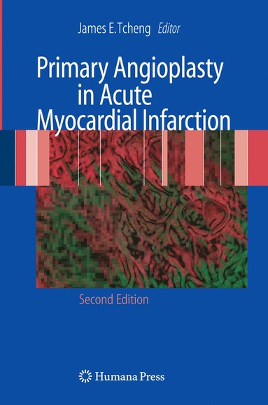 bokomslag Primary Angioplasty in Acute Myocardial Infarction