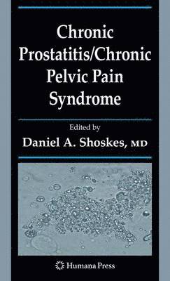 Chronic Prostatitis/Chronic Pelvic Pain Syndrome 1
