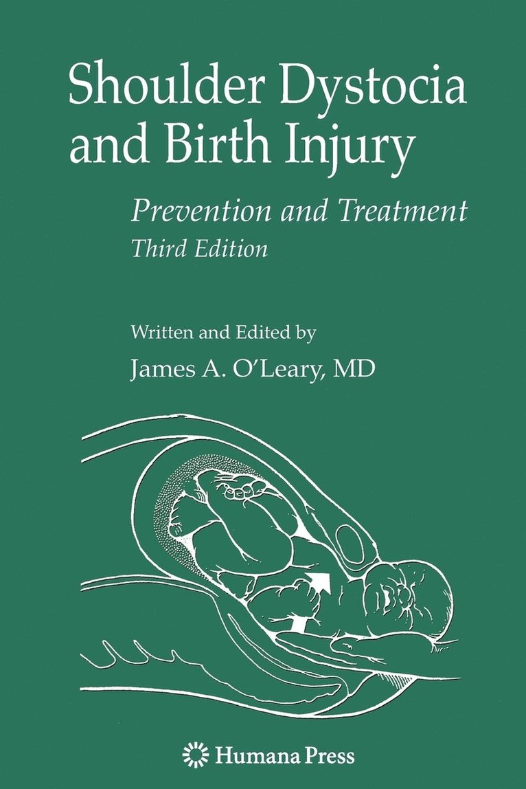 Shoulder Dystocia and Birth Injury 1