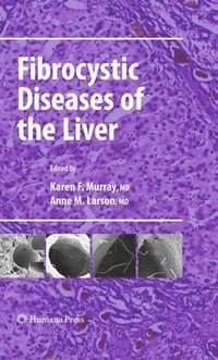 bokomslag Fibrocystic Diseases of the Liver