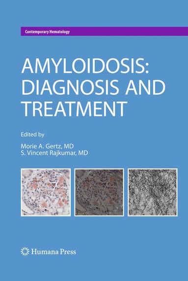 bokomslag Amyloidosis