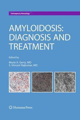 Morie A. Gertz, S. Vincent Rajkumar - Amyloidosis, Häftad