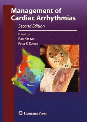 bokomslag Management of Cardiac Arrhythmias