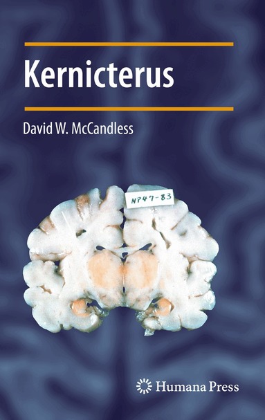 David W. McCandless - Kernicterus, Häftad