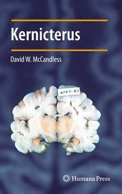 Kernicterus 1