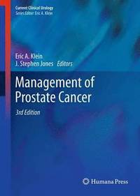 bokomslag Management of Prostate Cancer