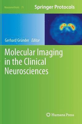 Molecular Imaging in the Clinical Neurosciences 1