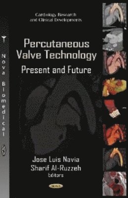 bokomslag Percutaneous Valve Technology
