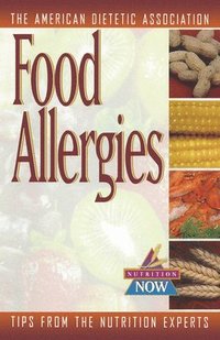 bokomslag Food Allergies