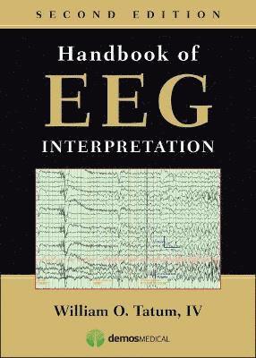 Handbook of Eeg Interpretation