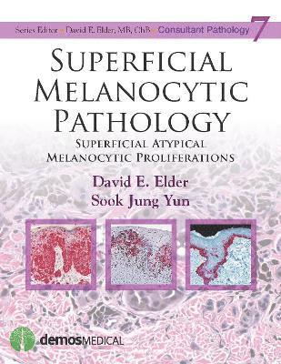 Superficial Melanocytic Pathology 1