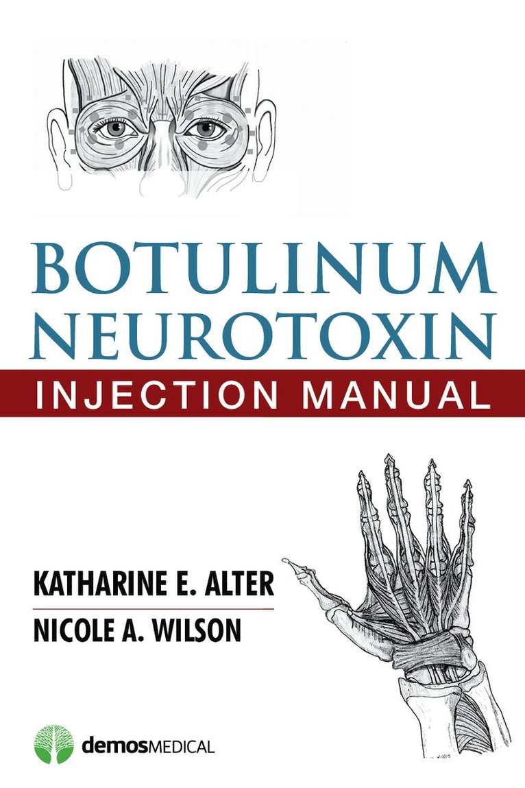 Katharine E. Alter, Nicole A. Wilson, MD Alter, Katharine E., MD Wilson, Nicole A., PhD, Katharine E. MD Alter, Nicole A. MD Wilson - Botulinum Neurotoxin Injection Manual, Häftad